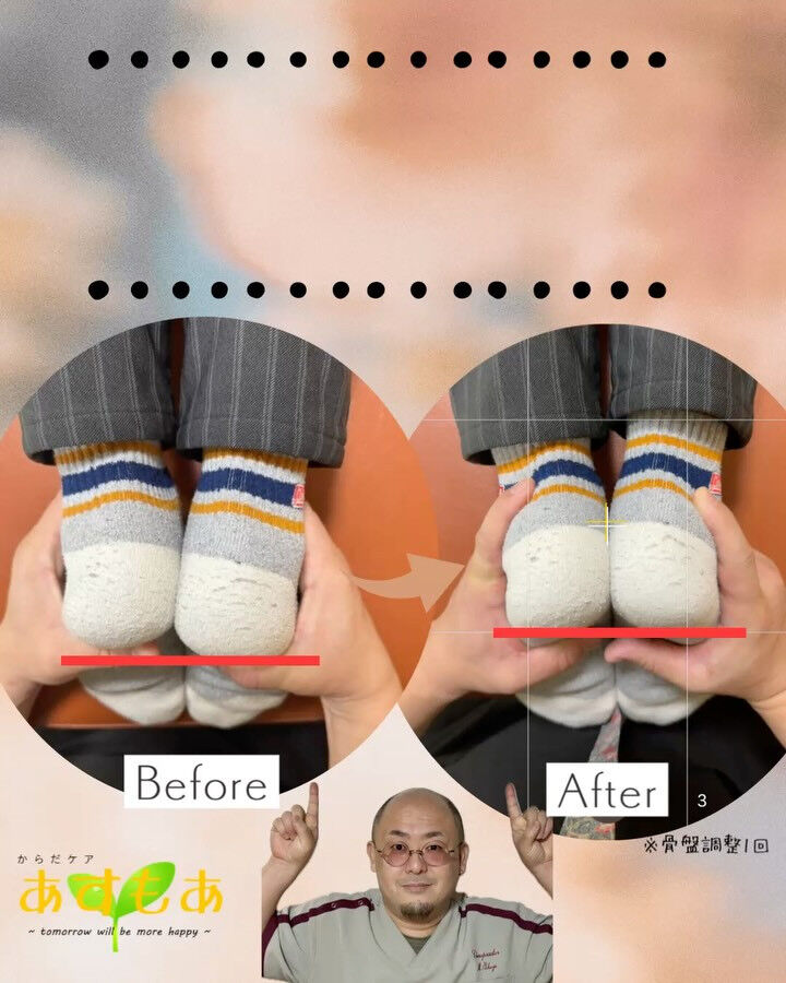 足の長さが違って見える原因は