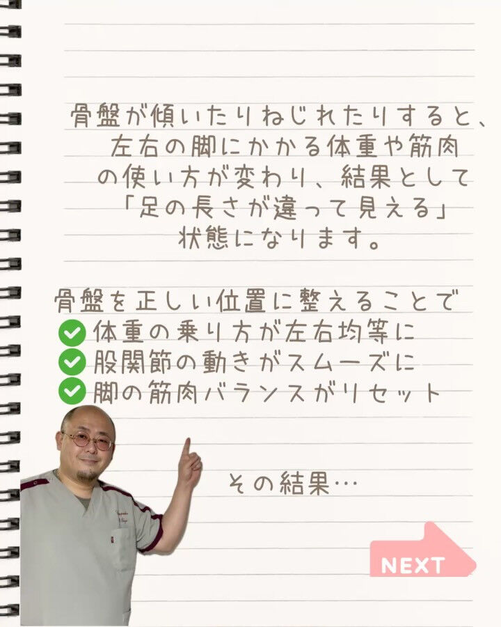 足の長さが違って見える原因は