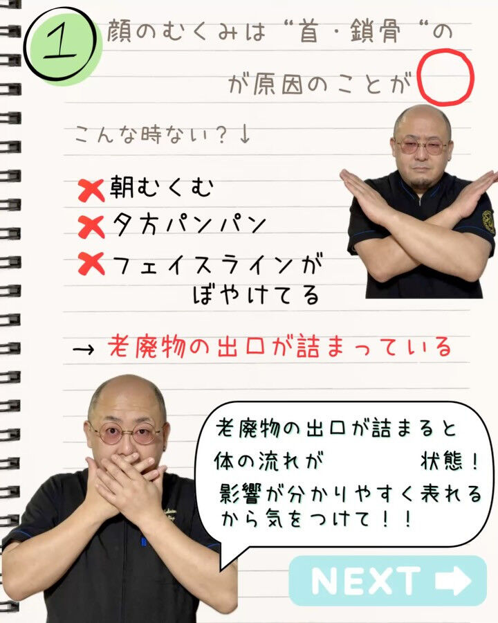 顔のむくみ、