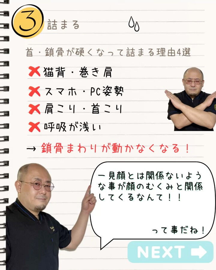 顔のむくみ、
