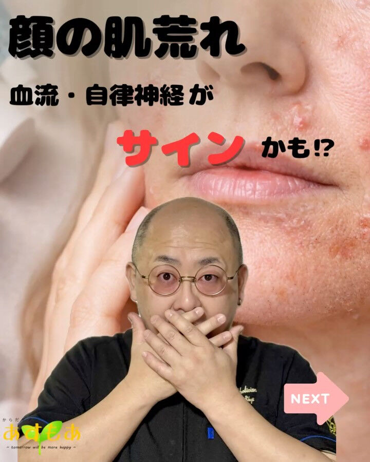 肌荒れ＝スキンケア不足