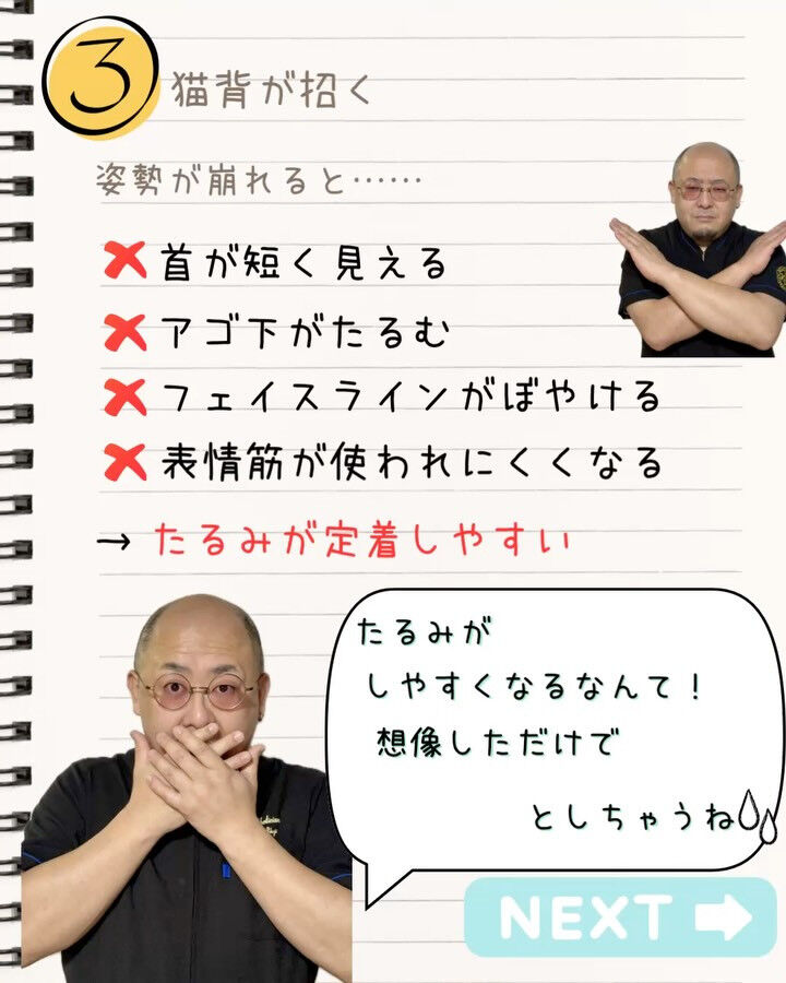 たるみ＝年齢のせい
