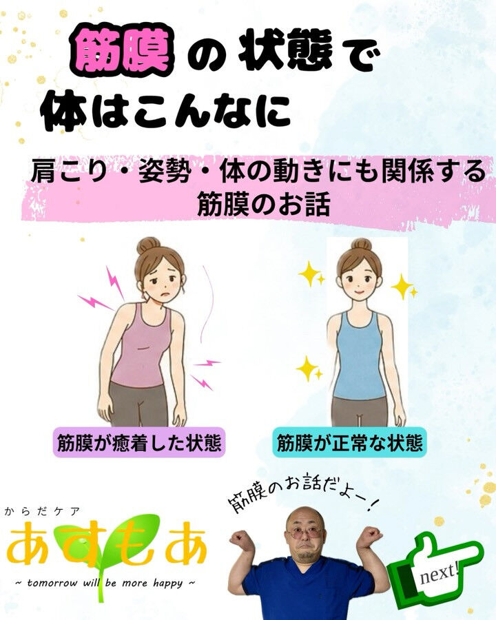 【筋膜の状態で体はこんなに変わる！】