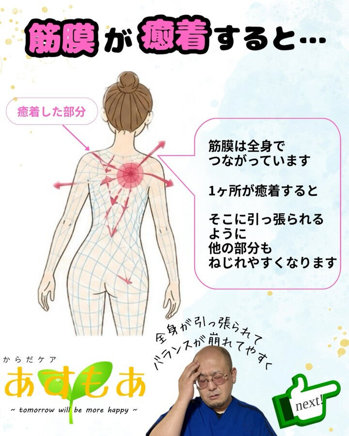 【筋膜の状態で体はこんなに変わる！】