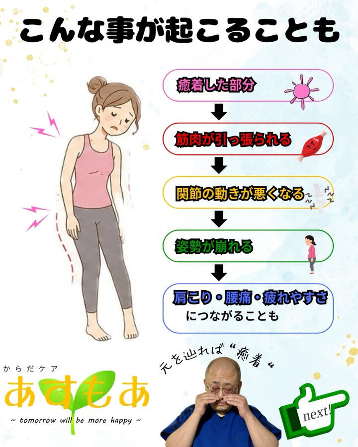 【筋膜の状態で体はこんなに変わる！】