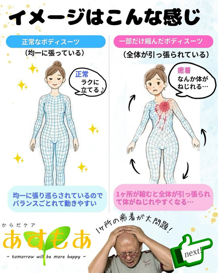 【筋膜の状態で体はこんなに変わる！】